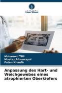 Anpassung des Hart- und Weichgewebes eines atrophierten Oberkiefers di Mohamed Tlili, Moetaz Alhousayni, Faten Khanfir edito da Verlag Unser Wissen