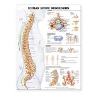 Human Spine Disorders Anatomical Chart edito da Anatomical Chart Co.