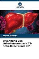 Erkennung von Lebertumoren aus CT-Scan-Bildern mit DIP di Rakesh Kumar Y edito da Verlag Unser Wissen