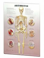Arthritis: 3d Lenticular Chart edito da Anatomical Chart Co.