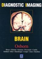 Diagnostic Imaging - Brain di Anne G. Osborn edito da Saunders