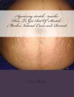 Agonizing Stretch Marks-How to Get Rid of Stretch Marks: Natural Cures and Remedi di Lisa Drake edito da Createspace