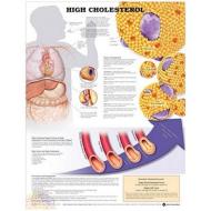High Cholesterol Anatomical Chart edito da Anatomical Chart Co.