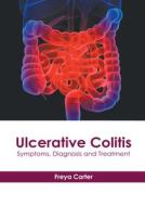Ulcerative Colitis: Symptoms, Diagnosis and Treatment edito da HAYLE MEDICAL