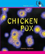 Chickenpox di Gretchen Hoffmann edito da Cavendish Square Publishing