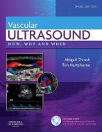Vascular Ultrasound di Abigail Thrush, Timothy Hartshorne edito da Elsevier Health Sciences