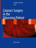 Cataract Surgery in the Glaucoma Patient edito da Springer-Verlag New York Inc.