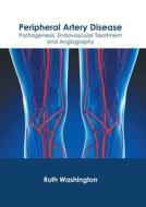 Peripheral Artery Disease: Pathogenesis, Endovascular Treatment and Angiography edito da FOSTER ACADEMICS