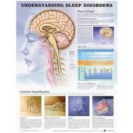 Understanding Sleep Disorders Anatomical Chart edito da Anatomical Chart Co.