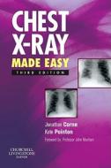 Chest X-ray Made Easy di Jonathan Corne, Kate Pointon edito da Elsevier Health Sciences