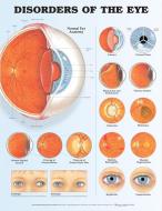 Disorders Of The Eye Anatomical Chart edito da Anatomical Chart Co.