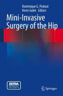 Mini-Invasive Surgery of the Hip edito da Springer Editions