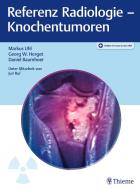 Referenz Radiologie - Knochentumoren di Markus Uhl, Georg W. Herget, Daniel Baumhoer edito da Georg Thieme Verlag