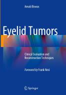 Eyelid Tumors di Arnab Biswas edito da Springer, India, Private Ltd