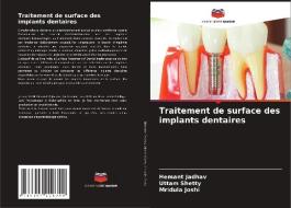 Traitement de surface des implants dentaires di Hemant Jadhav, Uttam Shetty, Mridula Joshi edito da Editions Notre Savoir