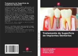 Tratamento de Superfície de Implantes Dentários di Hemant Jadhav, Uttam Shetty, Mridula Joshi edito da Edições Nosso Conhecimento
