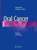 Oral Cancer edito da Springer Japan