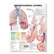Understanding Asthma Anatomical Chart edito da Anatomical Chart Co.