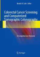 Colorectal Cancer Screening and Computerized Tomographic Colonography edito da Springer-Verlag GmbH