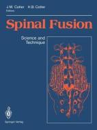 Spinal Fusion edito da Springer New York
