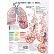 Understanding Asthma Anatomical Chart In Spanish (entendiendo El Asma) edito da Anatomical Chart Co.