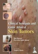 Clinical Synopsis and Color Atlas of Skin Tumors di Iffat Hassan, Peerzada Sajad Ahmad edito da Jaypee Brothers Medical Publishers