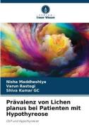 Prävalenz von Lichen planus bei Patienten mit Hypothyreose di Nisha Maddheshiya, Varun Rastogi, Shiva Kumar GC edito da Verlag Unser Wissen
