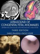 Ultrasound Of Congenital Fetal Anomalies di Dario Paladini, Paolo Volpe edito da Taylor & Francis Ltd