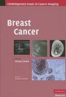 Breast Cancer edito da Cambridge University Press