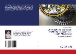 Chemical and Biological methods to Accelerate Tooth Movement di Monika Sorokhaibam edito da LAP LAMBERT Academic Publishing