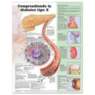 Understanding Type 2 Diabetes Anatomical Chart In Spanish (comprendiendo La Diabetes Tipo 2) edito da Anatomical Chart Co.
