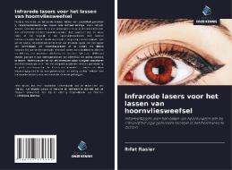 Infrarode lasers voor het lassen van hoornvliesweefsel di Rifat Rasier edito da Uitgeverij Onze Kennis