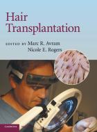 Hair Transplantation di Marc R. Avram edito da Cambridge University Press