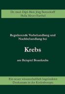 Regulierende Vorbehandlung und Nachbehandlung bei Krebs am Beispiel Brustkrebs di Jörg Bernsdorff, Hella Meyer-Barthel edito da Books on Demand