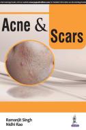 Acne & Scars di Ramanjit Singh edito da Jaypee Brothers Medical Publishers Pvt Ltd