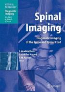 Spinal Imaging edito da Springer-verlag Berlin And Heidelberg Gmbh & Co. Kg