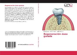 Regeneración ósea guiada di Eiti Agrawal, Rahul Chopra, Nikhil Sharma edito da EAE