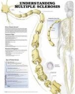 Understanding Multiple Sclerosis Anatomical Chart edito da Anatomical Chart Co.
