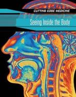Seeing Inside The Brain di Carol Ballard edito da Hachette Children's Books