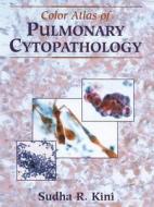 Color Atlas of Pulmonary Cytopathology di Sudha R. Kini edito da Springer New York