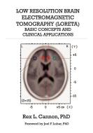 Low Resolution Brain Electromagnetic Tomography (LORETA) di Rex Cannon edito da BMED Press LLC