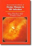 Illustrated Handbook Of Ocular Disease In Hiv Infection di Pauline L. Wilson, Marc C. I. Lipman, Timothy A. Gluck edito da Taylor & Francis Ltd