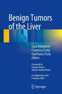 Benign Tumors of the Liver edito da Springer International Publishing
