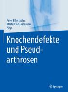 Knochendefekte und Pseudarthrosen di Peter Biberthaler, Martijn van Griensven edito da Springer-Verlag GmbH
