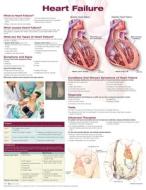 Heart Failure di Anatomical Chart Company edito da Lippincott Williams And Wilkins