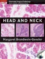 Brandwein-Gensler, M: Head and Neck di Margaret Brandwein-Gensler edito da Cambridge University Press