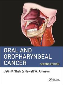 Oral And Oropharyngeal Cancer di Jatin P. Shah, E W Strong, Newell W. Johnson edito da Taylor & Francis Inc