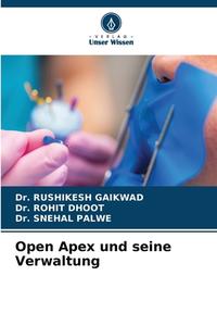 Open Apex und seine Verwaltung di Rushikesh Gaikwad, Rohit Dhoot, Snehal Palwe edito da Verlag Unser Wissen