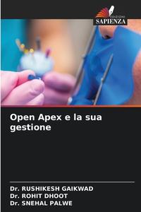 Open Apex e la sua gestione di Rushikesh Gaikwad, Rohit Dhoot, Snehal Palwe edito da Edizioni Sapienza