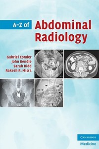 A-Z of Abdominal Radiology di Gabriel Conder edito da Cambridge University Press